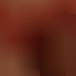 Mutandine rosse rotte